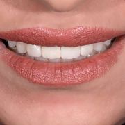 DESIGNING A PRIDE SMILE